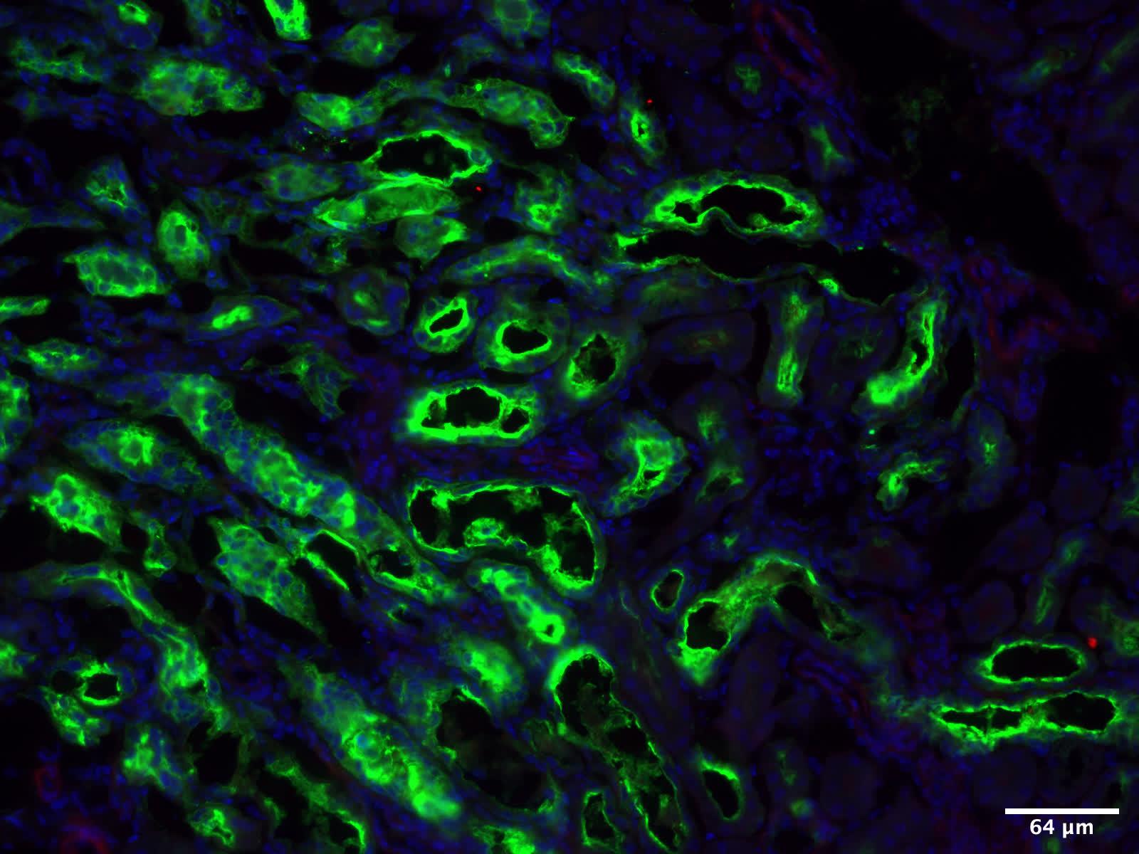 Cross-section of an injured kidney expressing KIM-1 (green) in the tubules.