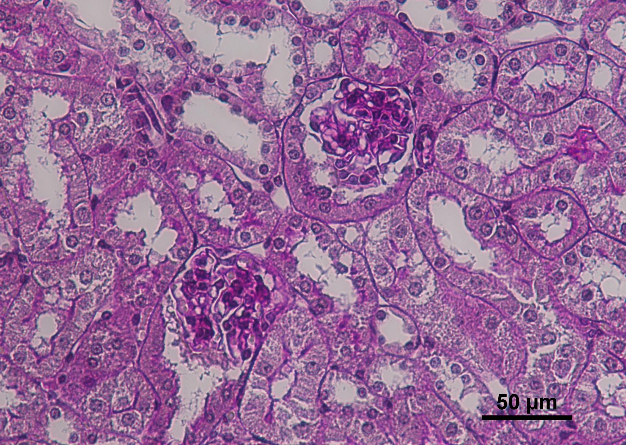 Kidney cross section of glomeruli (collection of blood vessels within the kidney).